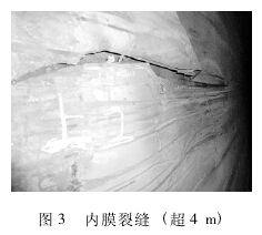 内膜裂缝 ( 超 4 m)